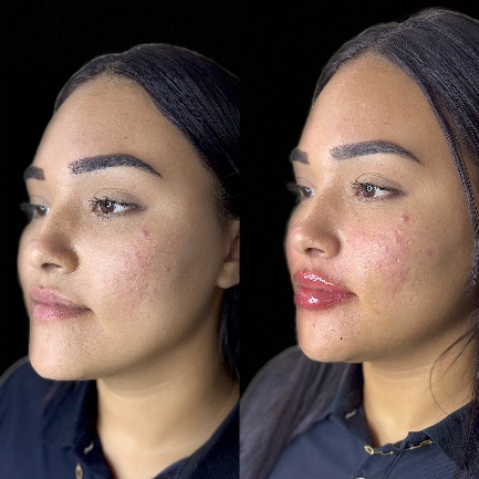 Full face